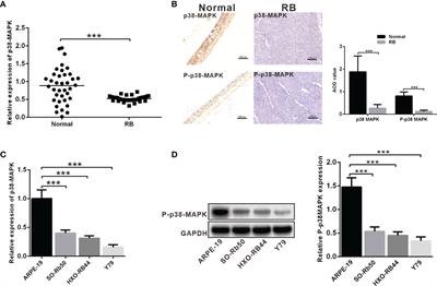 P38 Mitogen-Activated Protein Kinase Protects Against Retinoblastoma Through Regulating USP22/SIRT1/SOST Axis